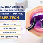 cong-nghe-han-tram-laser-tech