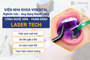 cong-nghe-han-tram-laser-tech